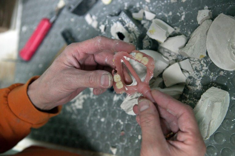 Protesi flessibili in odontoiatria dental point