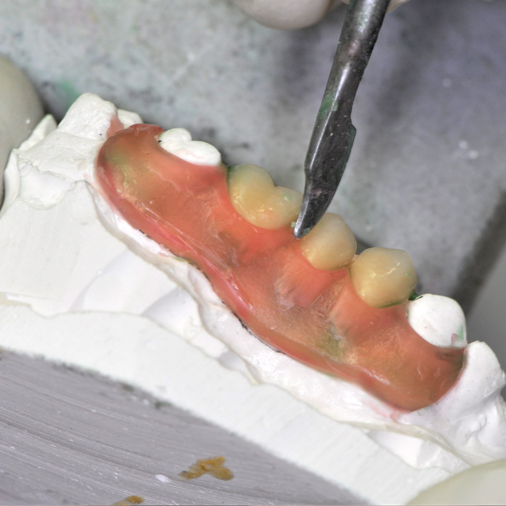 Laboratorio Dental Point Srl